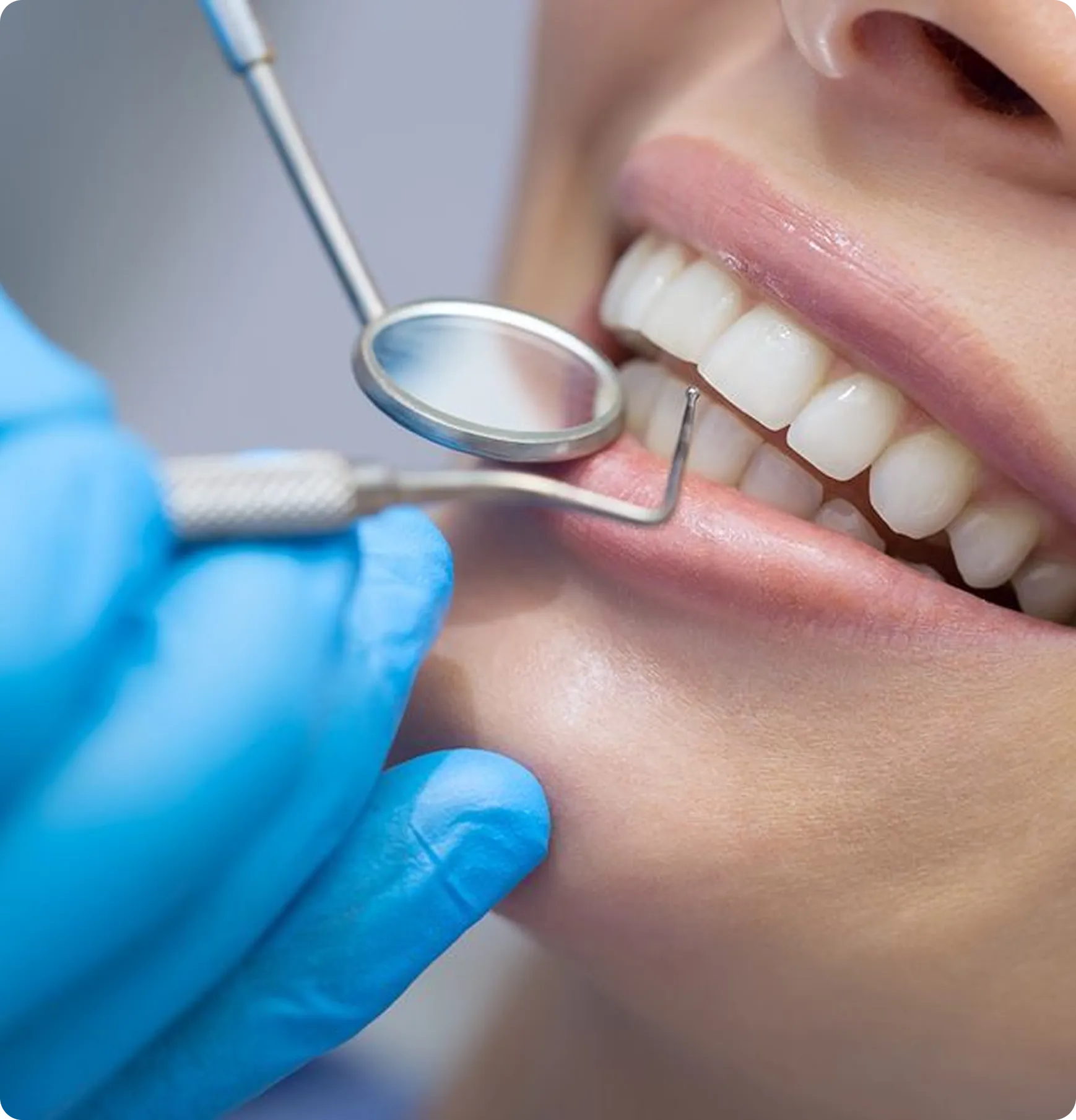 Dentist holding a shade guide against a smiling patient's teeth to match tooth color
