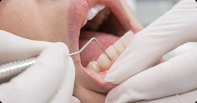 Dentist using a dental probe to examine a patient's teeth